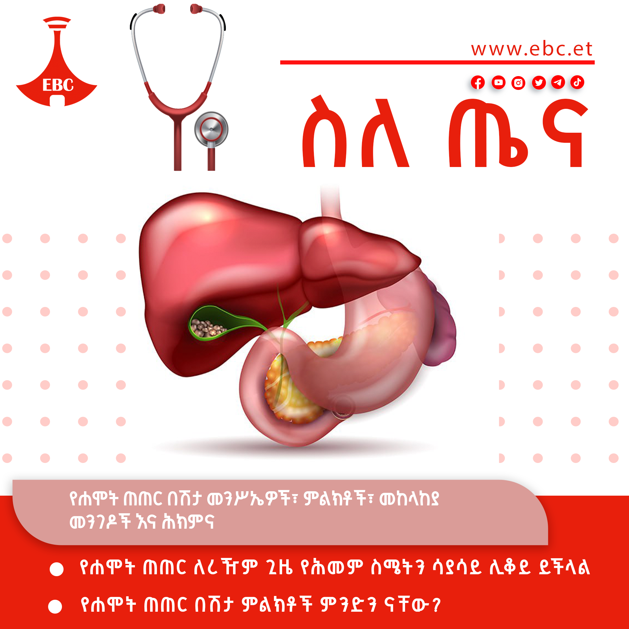 የሐሞት ጠጠር በሽታ መንሥኤዎች፣ ምልክቶች፣ መከላከያ መንገዶች እና ሕክምና