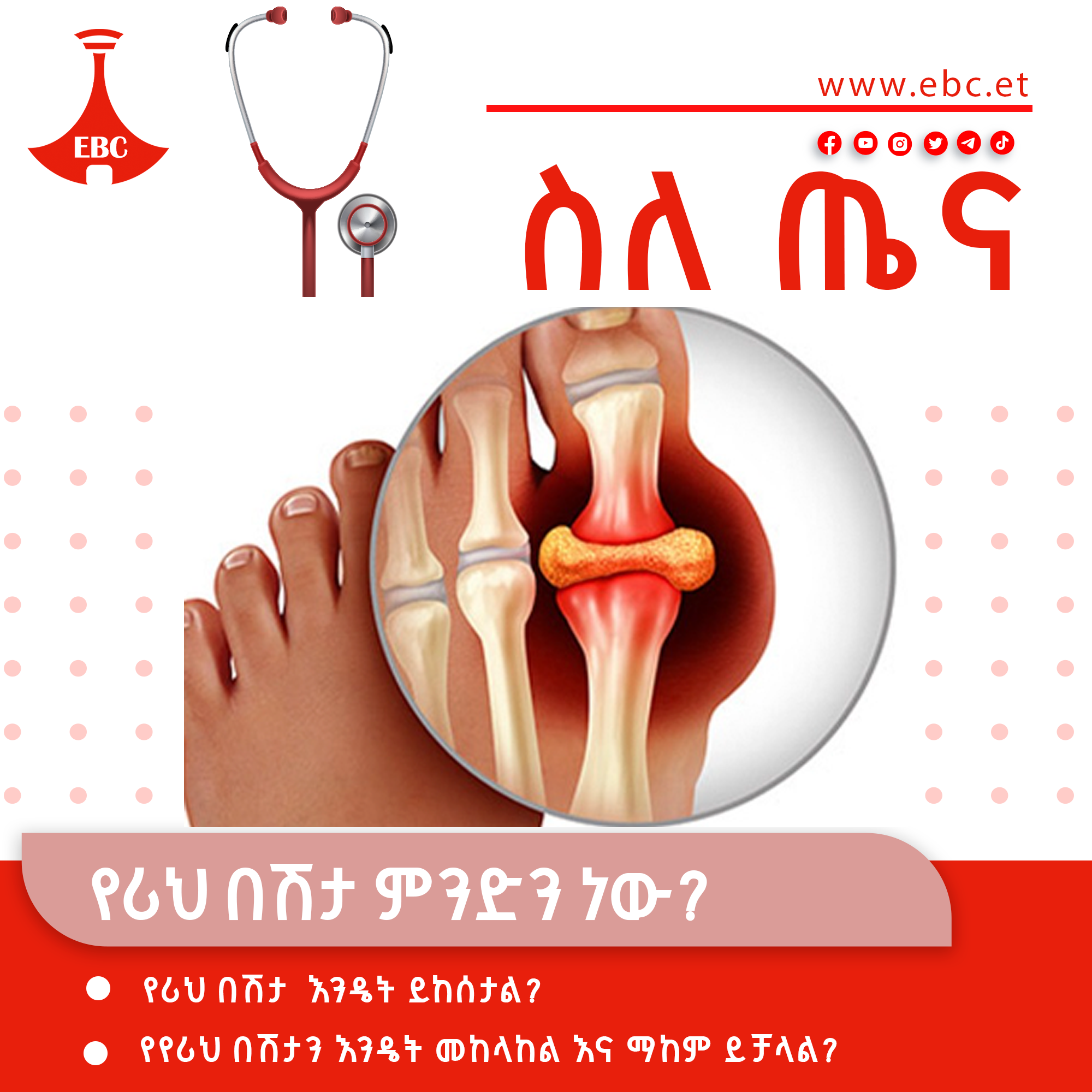 የሪህ በሽታ ምንድን ነው?