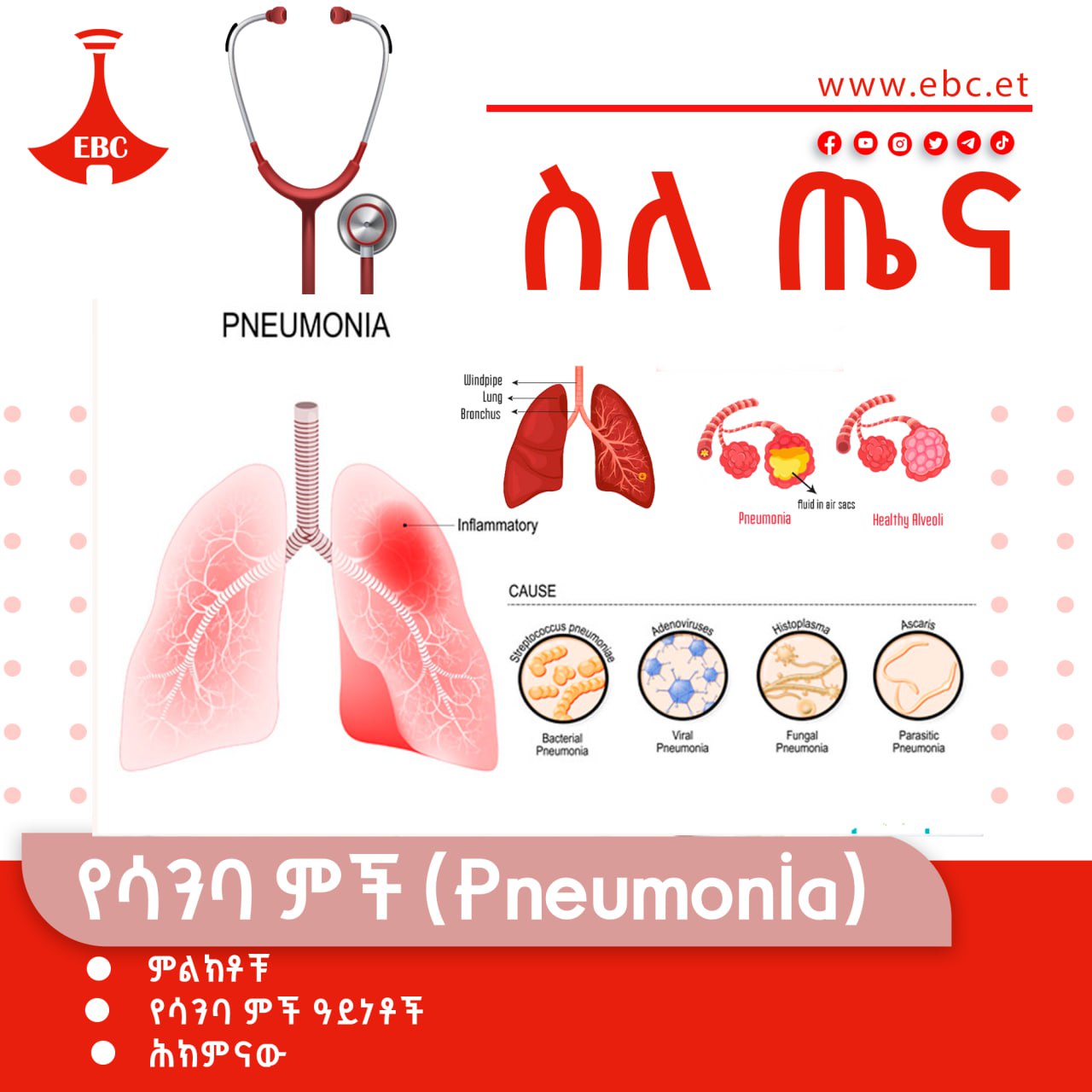 የሳንባ ምች (Pneumonia)
