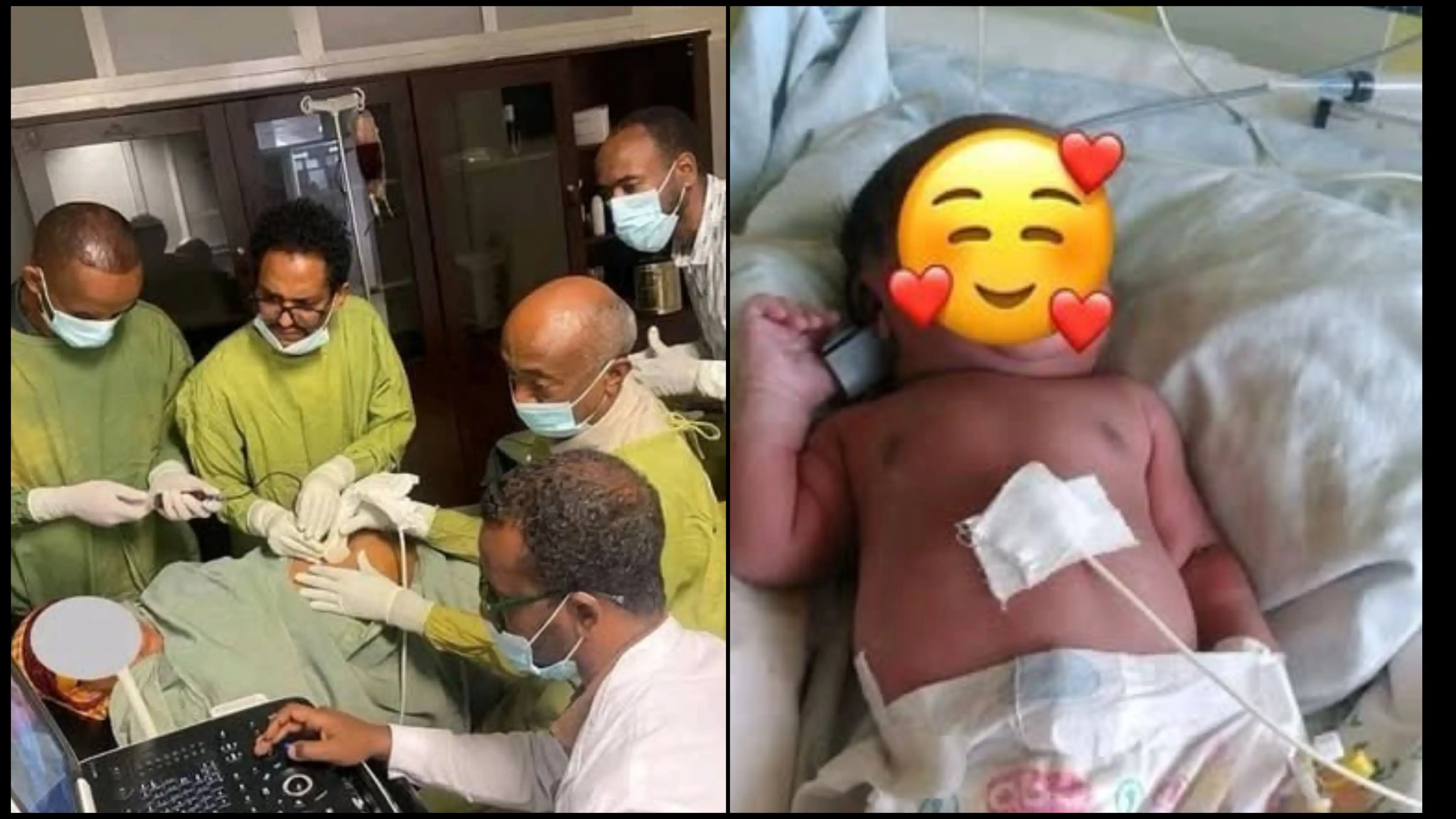 SECOND IN THE WORLD: Ethiopian Doctors Perform Historic 10-Time In-Utero Blood Transfusion to Save Baby