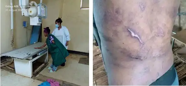 በቤት ሠራተኛዋ ላይ አካል እስከማጉደል ጥቃት ያደረሱት ተጠርጣሪዎች ተያዙ