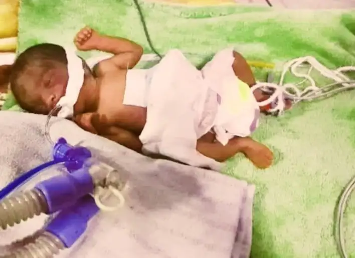 የሕክምና ባለሙያዎች “ተዓምር” ያሉት - ሲወለድ 900 ግራም የሚመዝነው ሕጻን