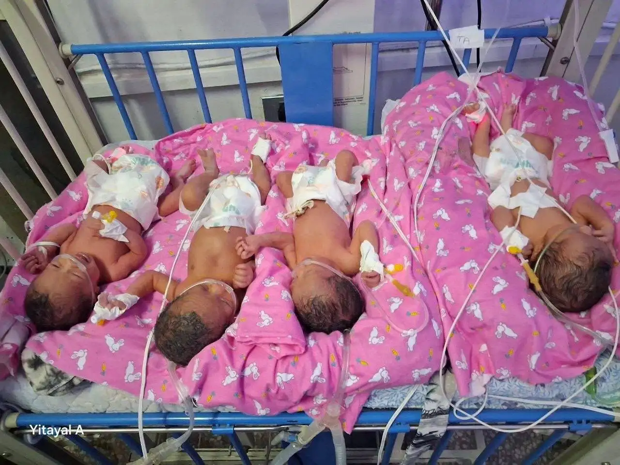 የ26 ዓመቷ እናት በአንድ ጊዜ አራት ሕፃናትን በሰላም ተገላገለች